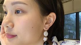 別小看身上的痣！這六種痣很常見　恐病變成癌症(記者郭奕均攝影)