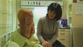 蠟融女玄熙好不容易等到募資手術，卻在復健後身亡。（圖／Naver）