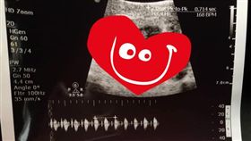 老婆肚子不舒服！他拿黑白「超音波照」問：腸胃炎嗎？（圖／翻攝自爆廢公社）
