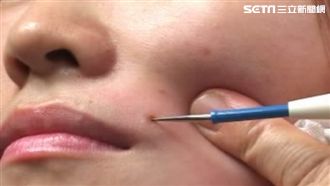 財神爺專屬記號！「4部位長痣」命中帶財