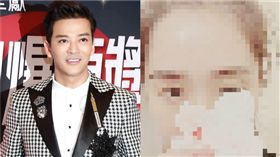 陳曉東,王妤嫻,受傷,就醫。（圖／陳曉東IG）