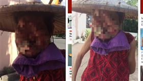 慎入！婦患罕病全臉變形　被譏「喪屍」與狗睡（圖／太陽報）