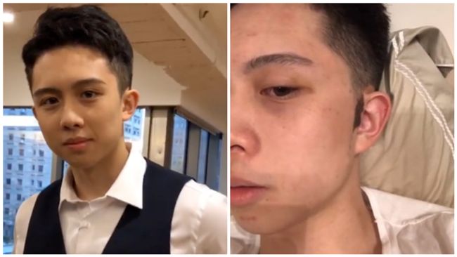 孫安佐右耳一塊黑　網放大一看全嚇傻