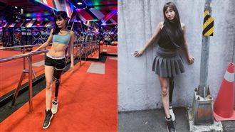 左腿截肢　24歲正妹健身熱舞超火辣