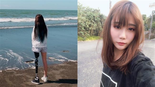 左腿截肢感情曾碰壁　正妹曝感人現況