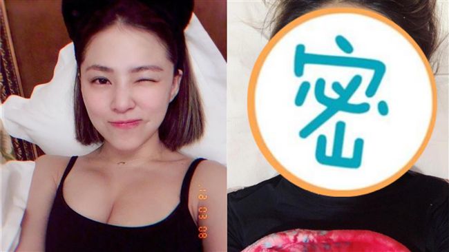 豪乳女星超激減肥！整臉插滿針變這樣