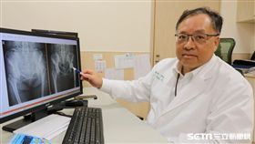 醫師黃揆洲說，吳女士因先天性髖臼發育不良，導致髖部疼痛。（圖／亞大醫院提供）