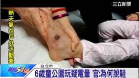 6歲童公園玩耍疑電暈 官:為何脫鞋