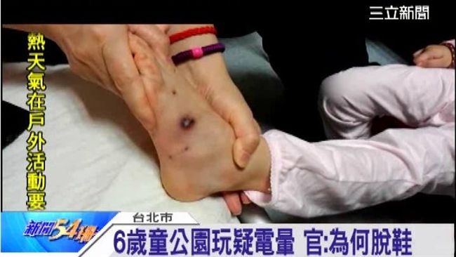 女童遭地燈電昏變遲緩　判國賠千萬元