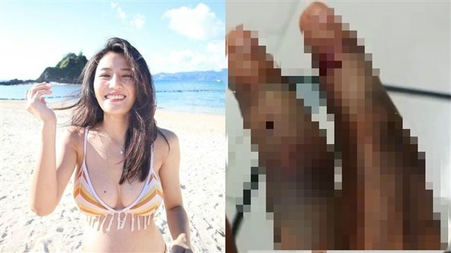 鐵門夾手！女星骨頭被夾碎指頭全發黑