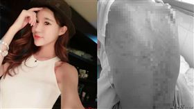 中國貴州,正妹女模,拔火罐,排毒,燒傷　（圖／翻攝自紅星新聞）