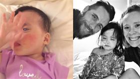 收養「銀眼」孤兒…被罵怪物！美國養父母決定摘除她雙眼
圖／翻攝自 Eryn Austin 臉書