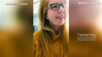 罕病女孩歌聲代替話語　嗓音感動網友