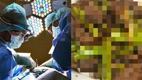 圖／翻攝pixabay,癌症,胰臟癌,抗癌,