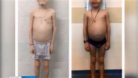 （圖／翻攝自YouTube）俄羅斯,養母,餵藥,挨餓