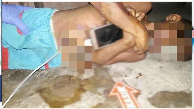 邊用手機邊充電！7歲童皮膚融化電死