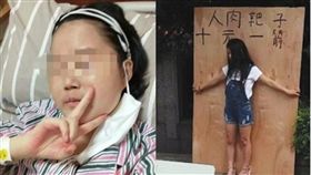 病逝,大陸.貴州,人肉,箭靶,血癌,籌錢,浙江,治療,化療,過敏,癲癇,昏迷　圖／翻攝自微博