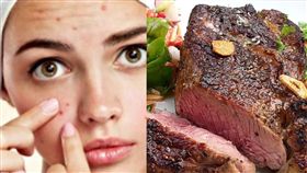 圖／翻攝自pixabay,牛排,痘痘