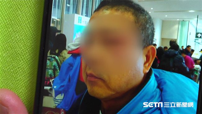 名醫遊日遭台人打　視力受損得休數月