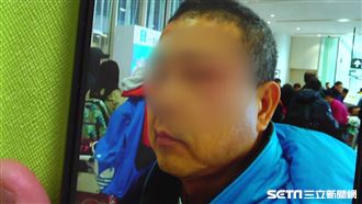 名醫遊日遭台人打　視力受損得休數月