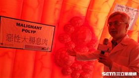 台大醫院內科部消化內科主治醫師李宜家說，透過糞便潛血檢查可以降低7%腸癌死亡風險。（圖／記者楊晴雯攝）