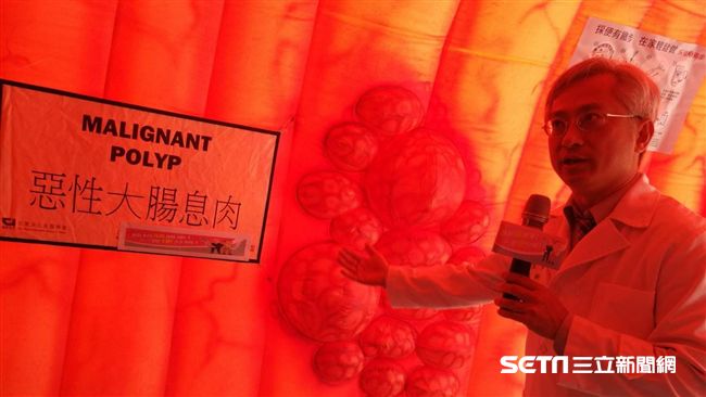 年逾萬人腸癌　靠這1管降7%死亡率