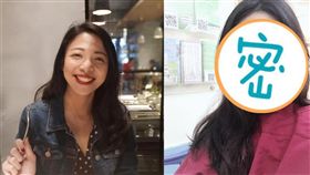 雪寶,下巴,骨頭粉碎／翻攝自雪寶臉書