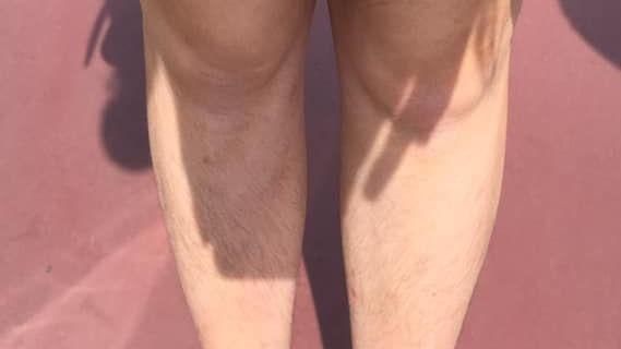 露腿毛被日本小情侶鄙視　辣台妹氣炸