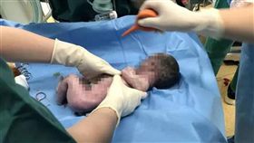 中國大陸,男嬰,早產,早產兒（圖／翻攝自新浪網）