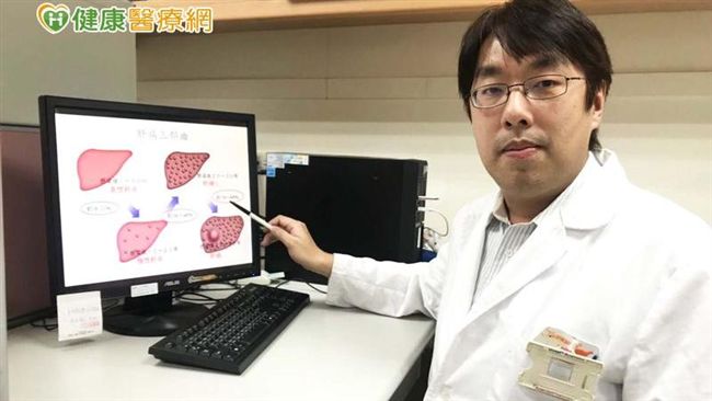 二線治療可幫助肝癌病患延長生機！