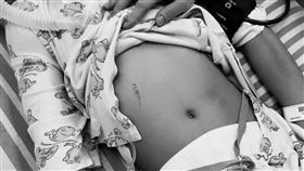 新北,基隆地檢署,家暴,虐童,女童,昏迷（圖，經變色處理／新北市議員張錦豪提供）