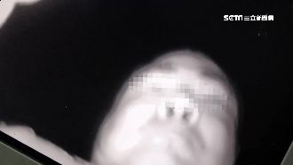 慣竊偷監視器鏡頭　「全臉入鏡」遭逮