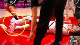 NBA／慎入！中鋒腿斷L型畫面曝光
NBA,波特蘭拓荒者,Jusuf Nurkic,斷腿
翻攝自推特