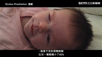 帥爸為女兒學做義眼　竟開啟第二人生