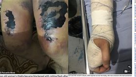 遭夫「人祭」安撫惡靈…女腿腐爛壞死　1歲女兒也遭殃（圖／每日郵報）