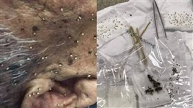 超恐怖！他被蜂群狂蜇　臉上插滿蜂針密密麻麻(圖/臉書)