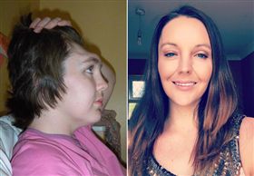 女子額頭嚴重受創