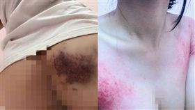 被未婚夫家暴，身體多處傷痕po上網請求協助，大家以為是愚人節玩笑，沒想到是真的!（圖／爆料公社官方網站）
