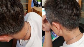 針灸回家抓頭竟發現頭上針漏拔 他嘆：才剛車禍(圖/爆怨公社)