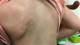 台南,虐童,繼父,體罰,女童,驗傷