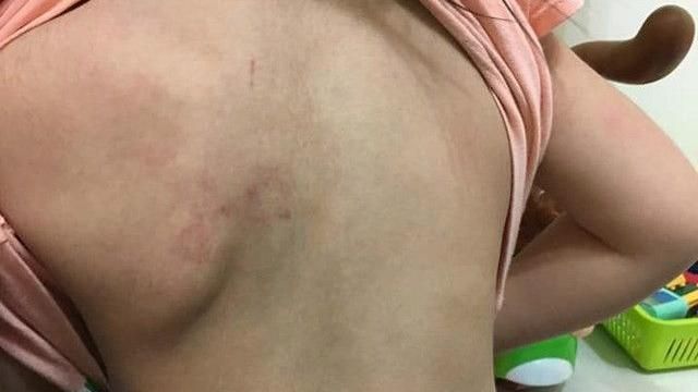 繼父虐打女童　認動手「沒一直打」！