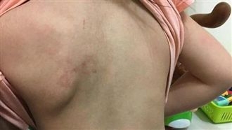 繼父虐打女童　認動手「沒一直打」！