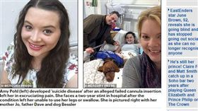 複雜性局部疼痛症候群,CPRS,英國,自殺病　（圖／每日郵報）