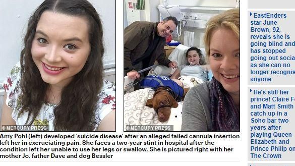 妙齡女罹患自殺病！風吹到皮膚都會痛