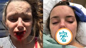 前任復合失敗「嘴唇咬一圈」留惡魔記號，女學生縫300針找到真愛。（圖／翻攝自太陽報）