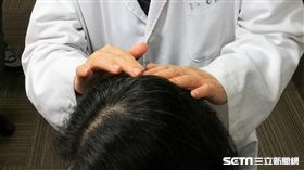 醫師劉國威建議，民眾平常別忘了檢查頭皮，若長不明凸起物2週未消，應盡速就醫診治。（圖／記者楊晴雯攝）
