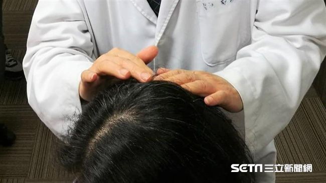 不痛不癢沒關係 頭皮長 凸起物 7症狀恐癌症轉移 生活 三立新聞網setn Com