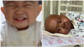 心疼！骨髓移殖後　2歲萌娃變黑人(圖/翻攝自梨視頻)