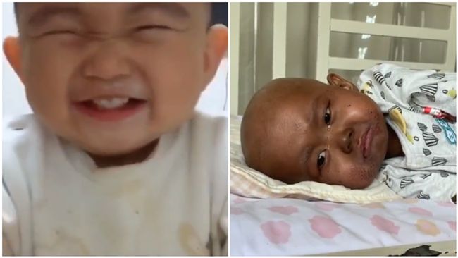 爸捐骨髓救她！病童卻變「黑人」險死