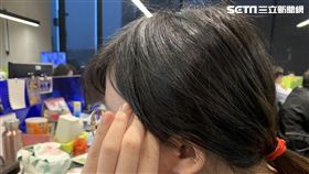 頭痛，偏頭痛，青春痘，頭暈，示意圖，不用寫記者名，寫資料照